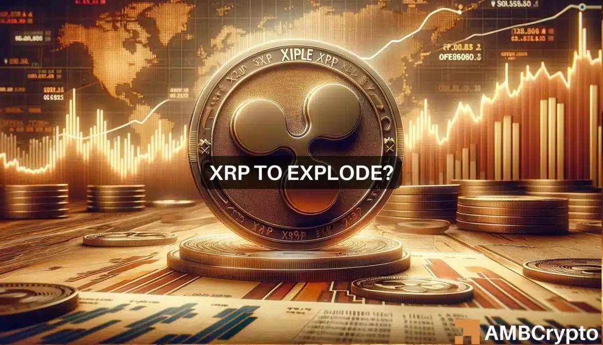 xrp医学上什么意思(rp医学上代表什么意思) xrp医学上什么意思(rp医学上代表什么意思)